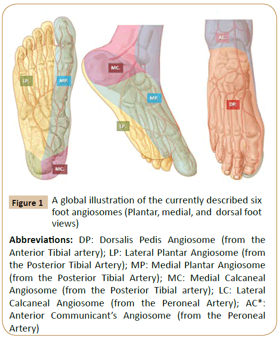vascular-endovascular-Dorsalis-Pedis