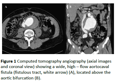 vascular-endovascular-surgery-Computed-tomography
