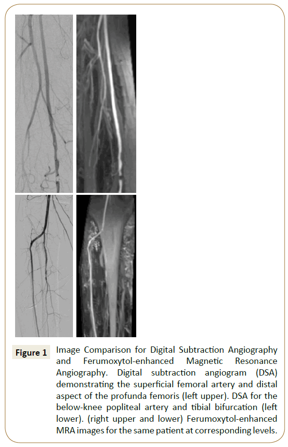 vascular-endovascular-surgery-Subtraction-Angiography
