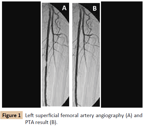 vascular-endovascular-surgery-femoral-artery