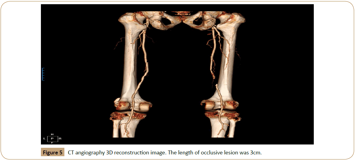 vascular-endovascular-surgery-reconstruction-image