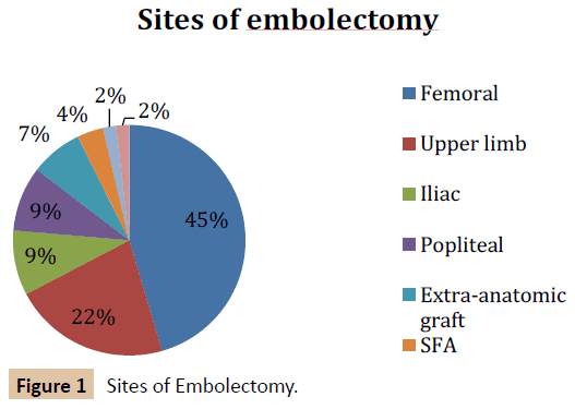 vascular-endovascular-therapy-Sites-Embolectomy