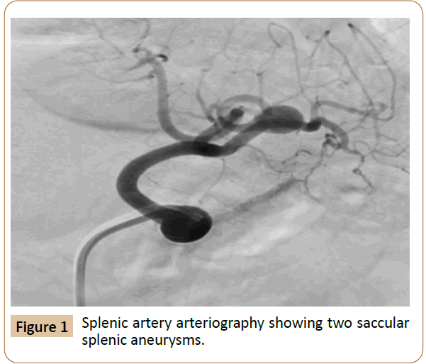 vascular-endovascular-therapy-aneurysms
