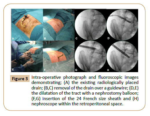 vascular-endovascular-therapy-fluoroscopic