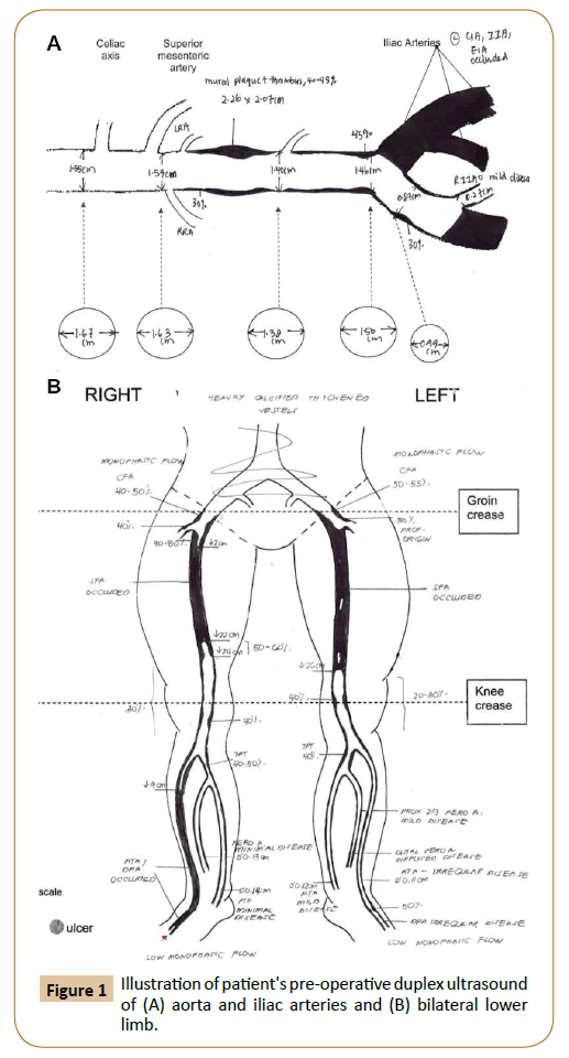 vascular-endovascular-therapy-patient