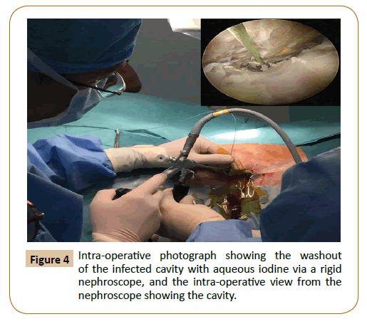 vascular-endovascular-therapy-photograph