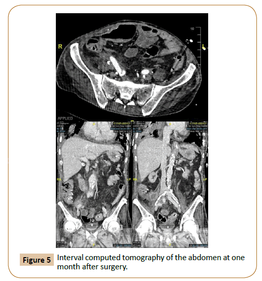 vascular-endovascular-therapy-tomography